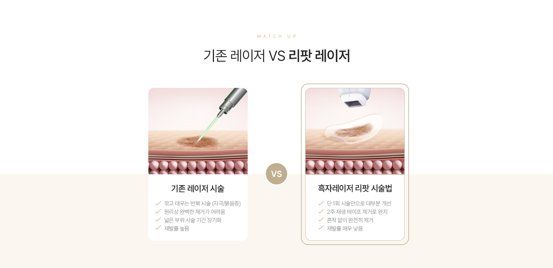리팟레이저 시술정보